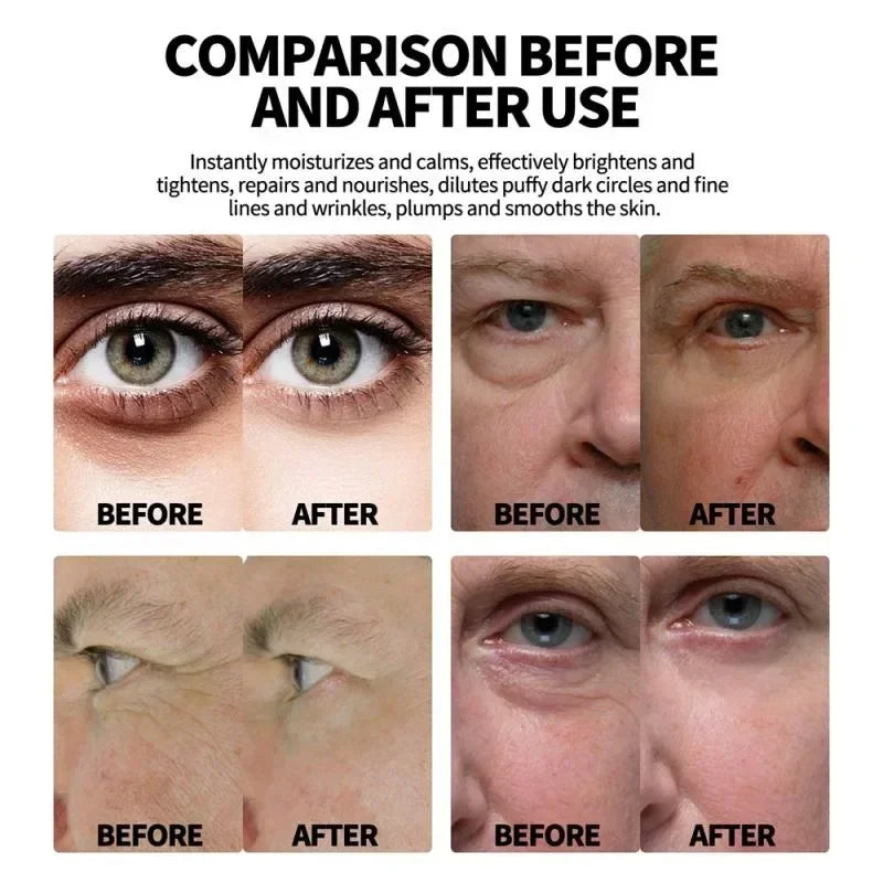 Hyaluronic Acid Eye Care