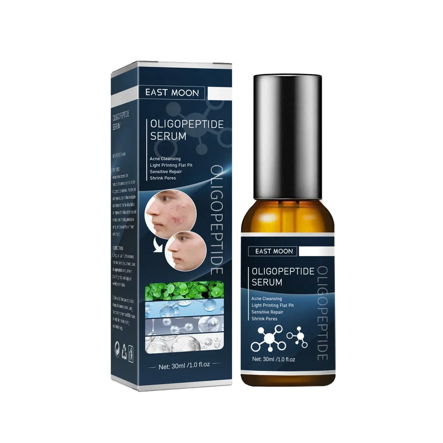 Men Acne Removal Serum