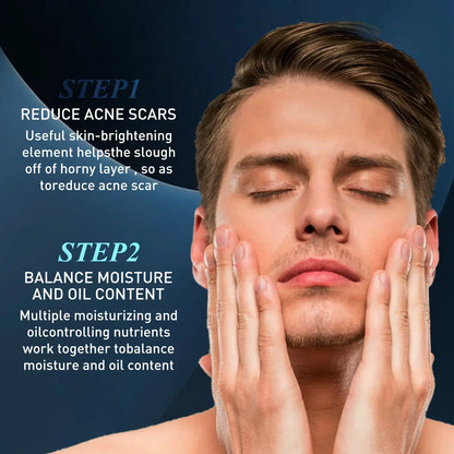 Men Acne Removal Serum